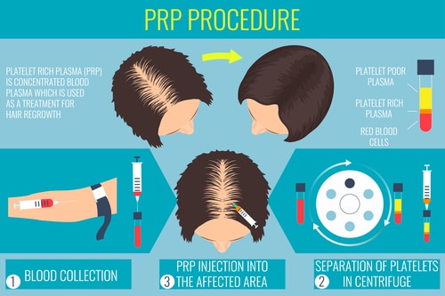 Prp procédure marrakech